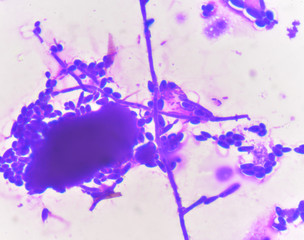 Budding yeast cells with pseudohyphae Gram stain method