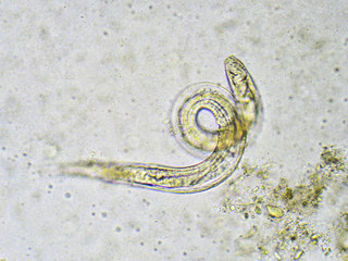 Strongyloides stercoralis (threadworm) in stool, analyze by microscope
