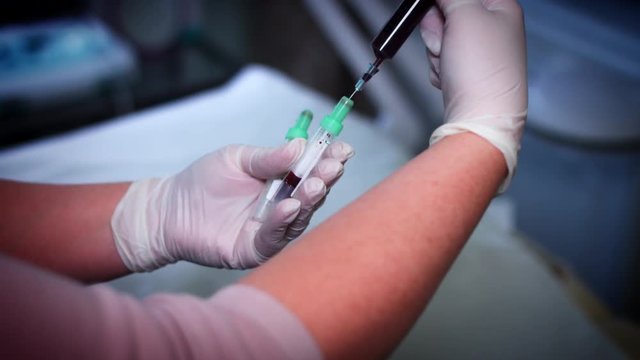 4K Doctor Preparing Blood for PRP Lifting Treatment