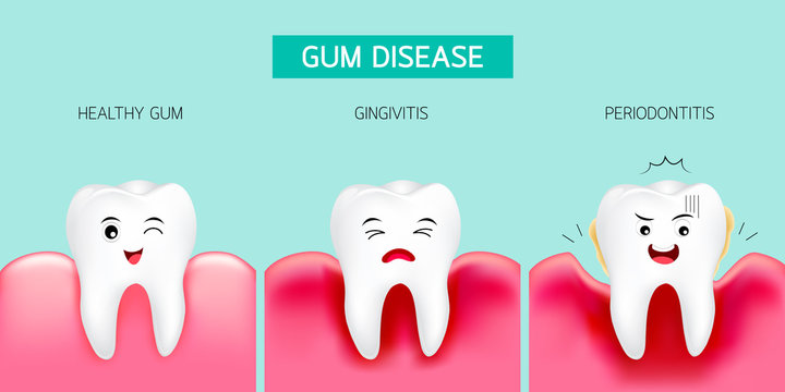Step of gum disease. Healthy tooth and gingivitis.Cute cartoon design, illustration isolated on green background. Dental care concept.