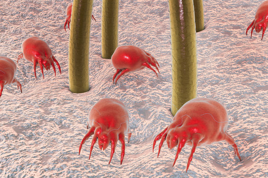 Dust mites Dermatophagoides on human skin with hairs, parasites which live in dust and furniture and whose excrements cause allergic reaction and asthma, 3D illustration