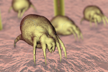 Dust mites Dermatophagoides on human skin with hairs, parasites which live in dust and furniture and whose excrements cause allergic reaction and asthma, 3D illustration