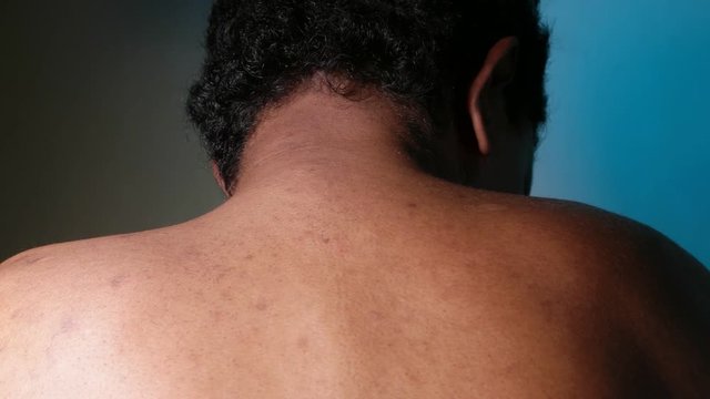 Close up of Human Skin Texture 
