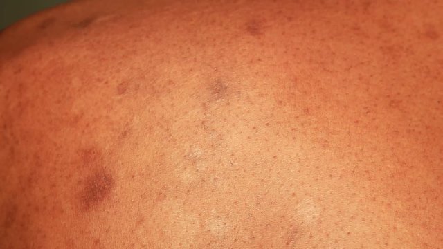 Close up of Human Skin Texture 
