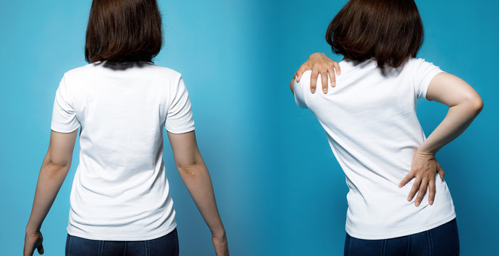 Good posture and bad posture. chiropractic before after image. woman's body and backbone.