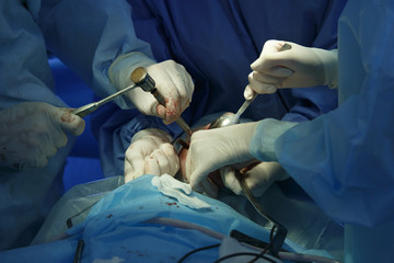 Surgeon uses surgical mallet during the maxillofacial surgery close up