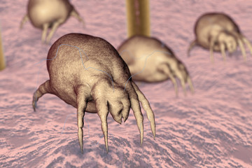 Dust mites Dermatophagoides on human skin with hairs, parasites which live in dust and furniture and whose excrements cause allergic reaction and asthma, 3D illustration