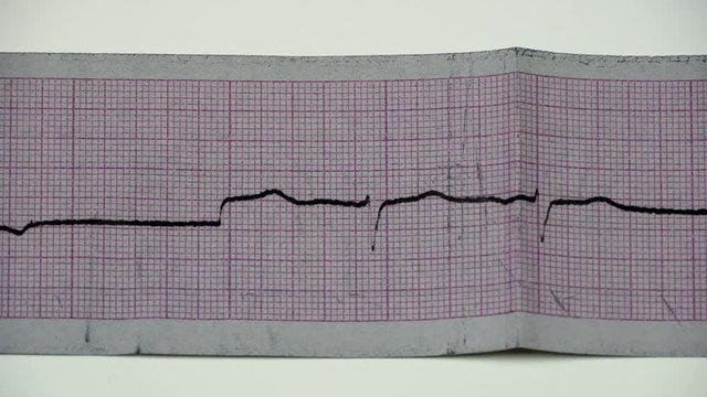 Paper tape with the record the schedule of heart. Cardiogram on a paper tape.