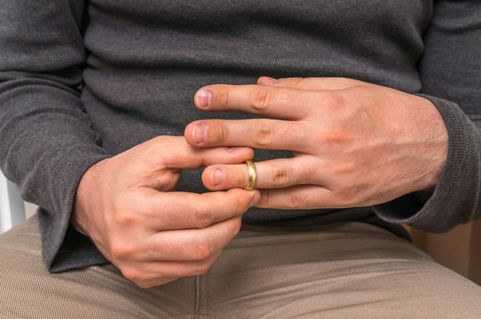 Man is taking off his wedding ring - divorce concept
