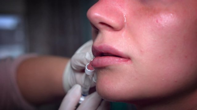 4K Woman Face with Injection Lip Filler