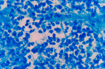 Moderate blue white blood cells.