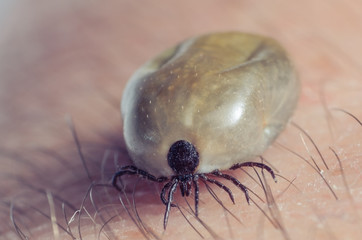 Tick filled with blood sitting on human skin