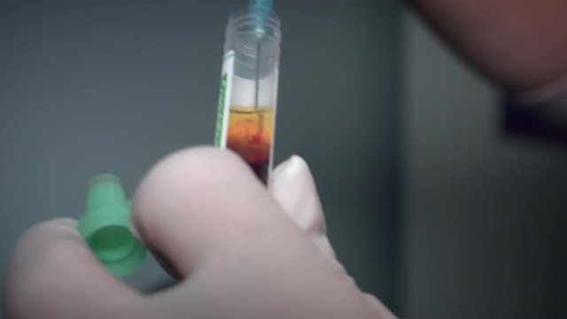 4K Close-up Doctor Collecting Plasma for PRP Facelift