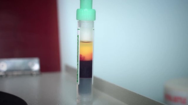 4K Plasma with Blood Cells left in Tube