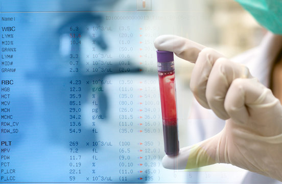 scientist do blood inspection and background with its report in laboratory experimental