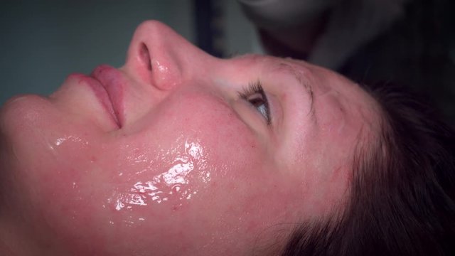 4K Doctor Applying Gel on Woman Face for Procedure