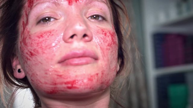 4K Woman Face with blood after Microneedling Procedure