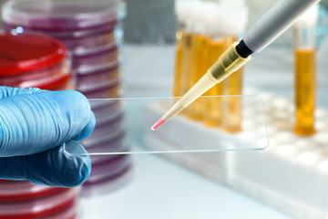 Hand of the lab technician holding a slide and depositing a sample / technician preparing sample in...