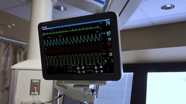 A fictional hospital medical computer scanner screen monitoring a patient's heart. Loopable.  	