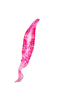 Zeuxapta sp. is platwormen (Platyhelminthes) infection in the gill on slide under microscope view.