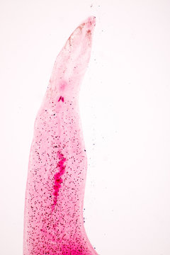 Zeuxapta sp. is platwormen (Platyhelminthes) infection in the gill on slide under microscope view.