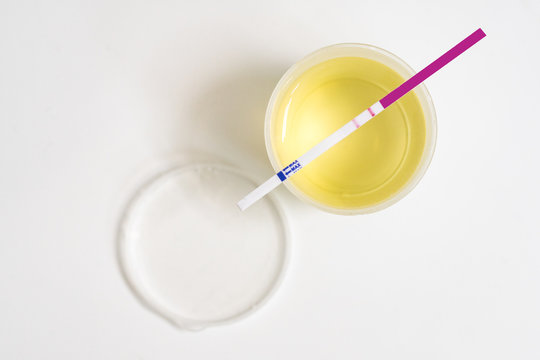 Methamphetamine Test of urine for health check