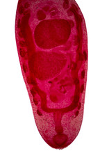 Paramphistomum is a genus of parasitic flat worms belonging to the digenetic trematodes.