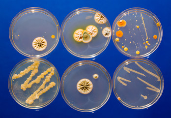petri dish samples with bacteria and fungal colonies