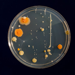 petri dish samples with bacteria and fungal colonies