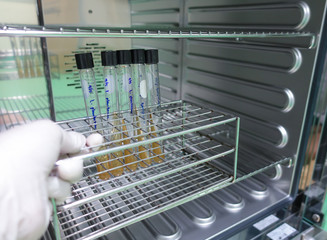 laboratory microbiology bacteria agar tube in incubator blue color tone - obrazy, fototapety, plakaty