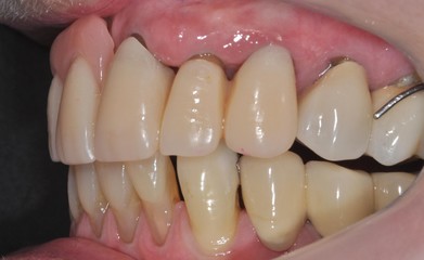 Initial Dental Treatment