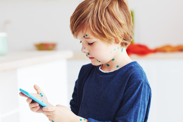 cute young boy, kid having chicken pox, that is cured with brilliant green antiseptic at home