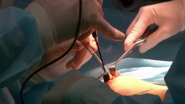 Plastic surgery an operating room