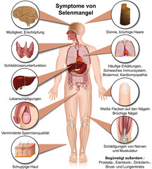 Symptome des menschlichen Körpers bei Selenmangel - obrazy, fototapety, plakaty