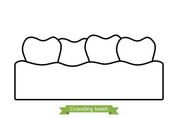 crowding teeth ( malocclusion ) - cartoon vector outline style
