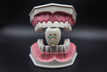 Model Cute toys teeth in dentistry on a black background.