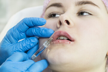 Cosmetic treatment with injection in a clinic 