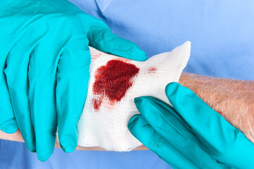 Nurse tending to wound