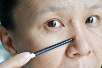 asian woman point mole on her face and nose