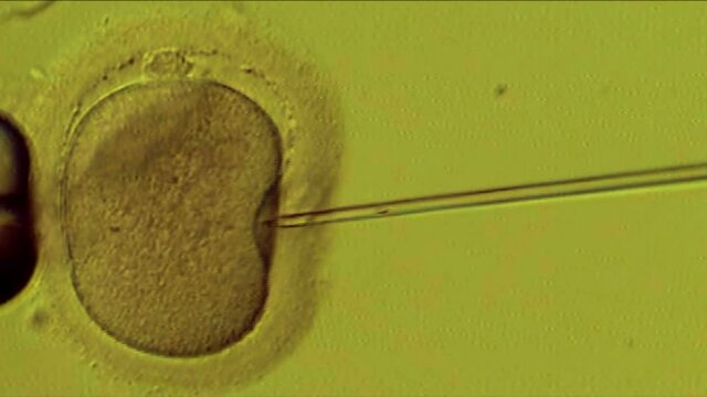IVF in the clinic