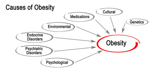 Causes of Obesity