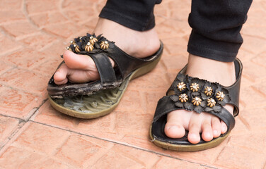 The soles of the shoes of this not a hindrance in my journey. Repair using glue These shoes can be used for a long time.