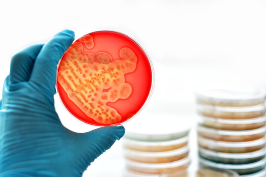 Colonies of bacteria in blood agar (culture medium plate)
