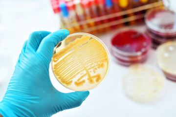 Colonies of bacteria in petri 