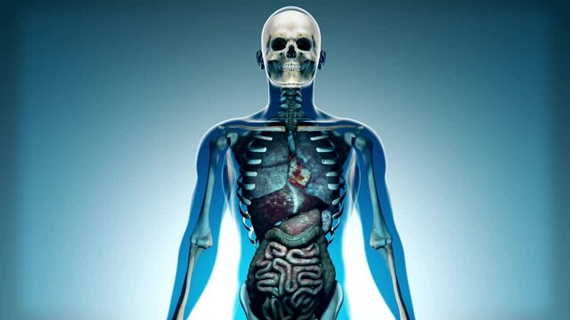Internal Organs Get Sick in a Transparent Human Body Anatomical 3D Animation