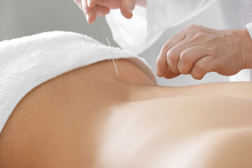 Young man undergoing acupuncture treatment in salon