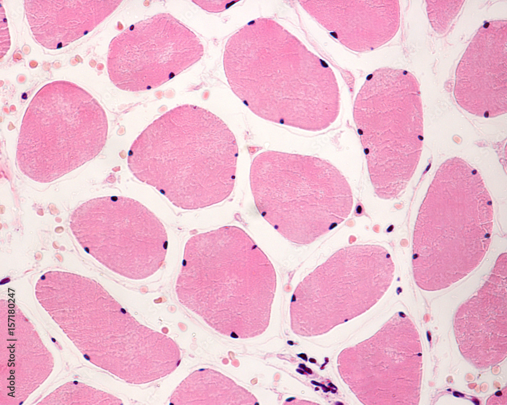 Sticker striated muscle fibers