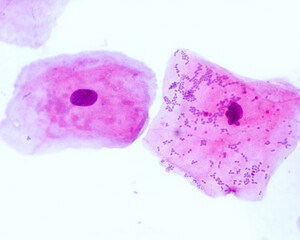 Squamous epithelial cells