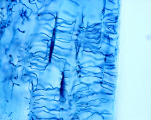 Osteocytes. Schmorl’s technique