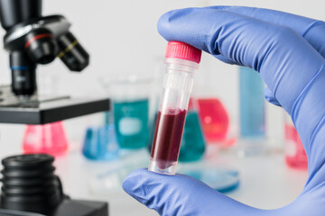 Analysis of samples laboratory. Medical Research and science